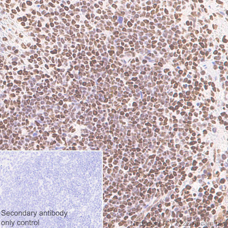 Immunohistochemistry (Formalin/PFA-fixed paraffin-embedded sections) - Anti-SMARCC1/BAF155 antibody [EPR25109-77] - BSA and Azide free (AB305038)