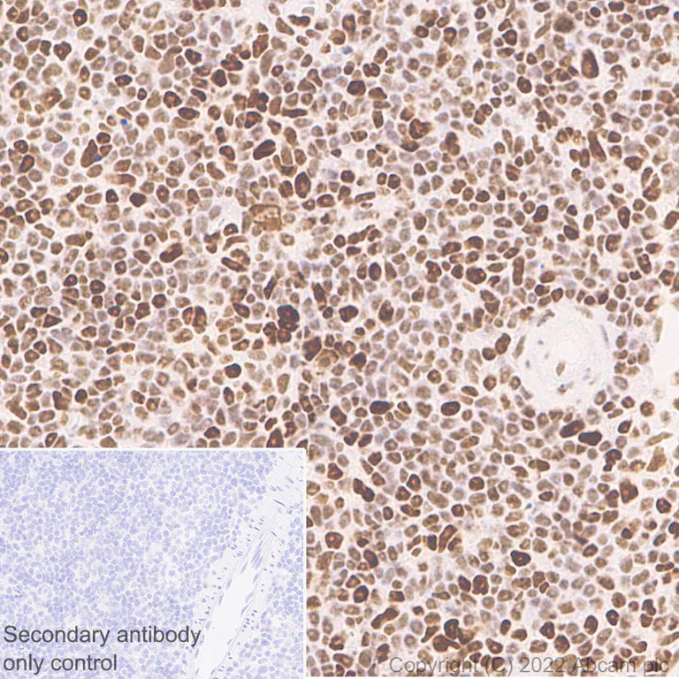 Immunohistochemistry (Formalin/PFA-fixed paraffin-embedded sections) - Anti-SMARCC1/BAF155 antibody [EPR25109-77] - BSA and Azide free (AB305038)