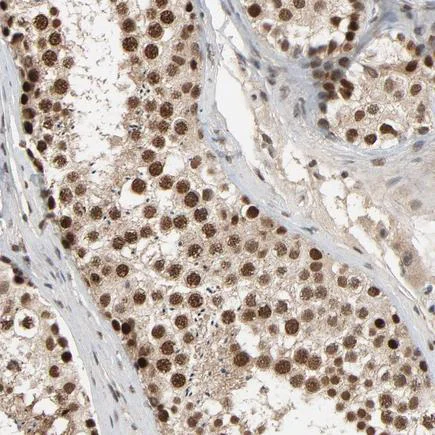 Immunohistochemistry (Formalin/PFA-fixed paraffin-embedded sections) - Anti-SMARCD1 antibody (AB224229)