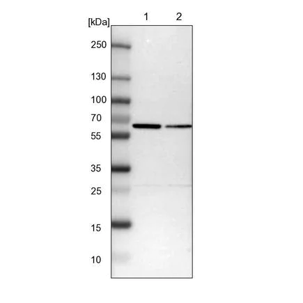 Western blot - Anti-SMARCD1 antibody (AB224229)