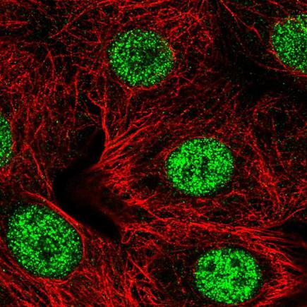 Immunocytochemistry/ Immunofluorescence - Anti-SMARCD2 antibody (AB221168)
