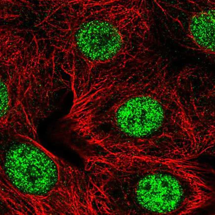 Immunocytochemistry/ Immunofluorescence - Anti-SMARCD2 antibody (AB221168)