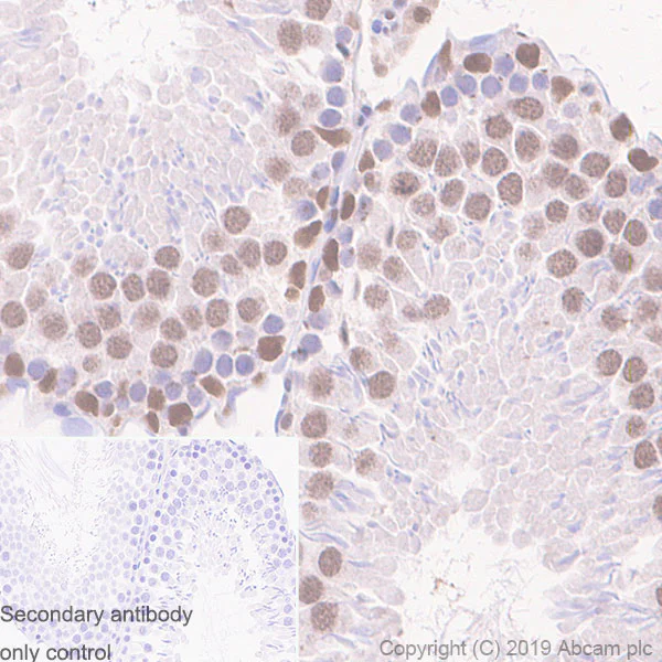 Immunohistochemistry (Formalin/PFA-fixed paraffin-embedded sections) - Anti-SMARCD2 antibody [EPR20860-251] - BSA and Azide free (AB256304)