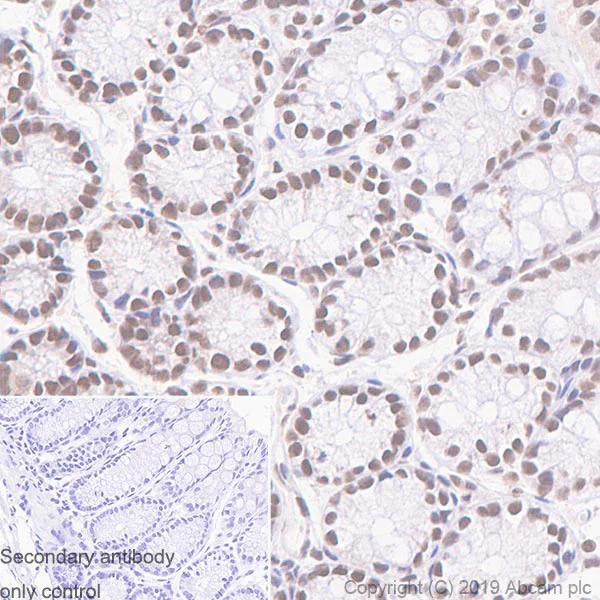 Immunohistochemistry (Formalin/PFA-fixed paraffin-embedded sections) - Anti-SMARCD2 antibody [EPR20860-251] - BSA and Azide free (AB256304)