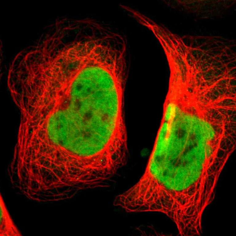Immunocytochemistry/ Immunofluorescence - Anti-SMARCE1 Antibody (AB327181)