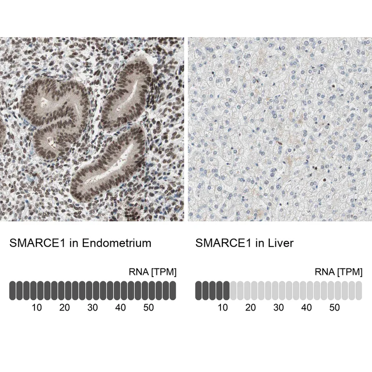 Immunohistochemistry (Formalin/PFA-fixed paraffin-embedded sections) - Anti-SMARCE1 Antibody (AB327181)
