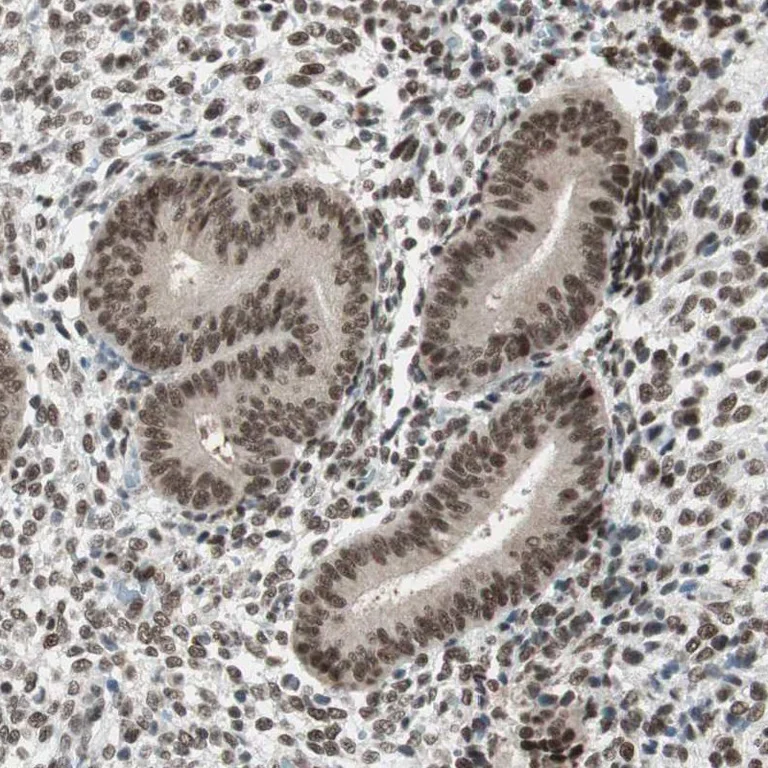 Immunohistochemistry (Formalin/PFA-fixed paraffin-embedded sections) - Anti-SMARCE1 Antibody (AB327181)