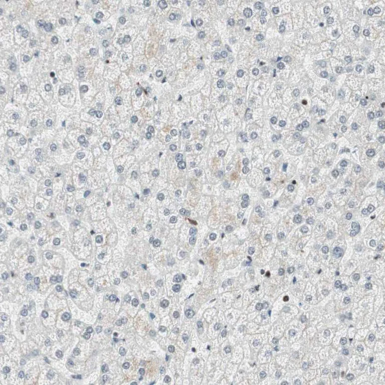 Immunohistochemistry (Formalin/PFA-fixed paraffin-embedded sections) - Anti-SMARCE1 Antibody (AB327181)