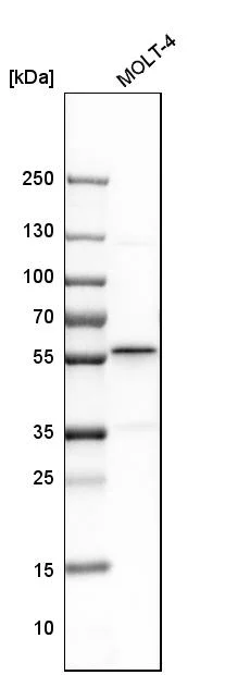 Western blot - Anti-SMARCE1 Antibody (AB327181)