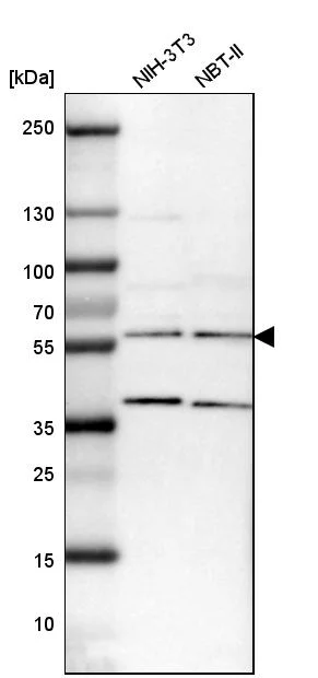 Western blot - Anti-SMARCE1 Antibody (AB327181)