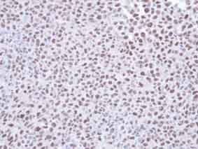Immunohistochemistry (Formalin/PFA-fixed paraffin-embedded sections) - Anti-SMC1A antibody (AB137707), expandable thumbnail