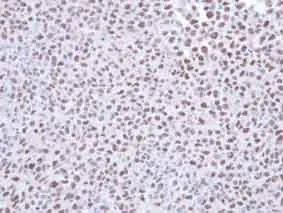 Immunohistochemistry (Formalin/PFA-fixed paraffin-embedded sections) - Anti-SMC1A antibody (AB137707)