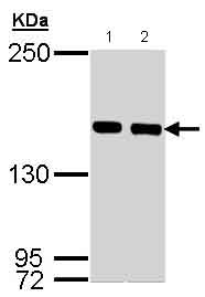 Western blot - Anti-SMC1A antibody (AB137707), expandable thumbnail