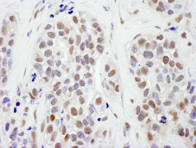 Immunohistochemistry (Formalin/PFA-fixed paraffin-embedded sections) - Anti-SMC1A antibody (AB140493)