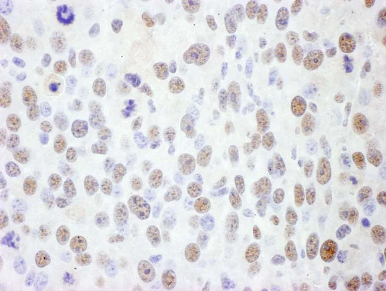 Immunohistochemistry (Formalin/PFA-fixed paraffin-embedded sections) - Anti-SMC1A antibody (AB140493)