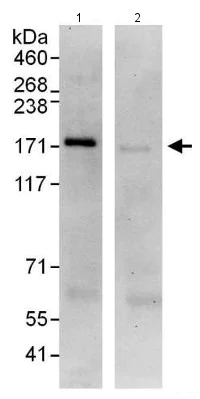 Immunoprecipitation - Anti-SMC1A antibody (AB140493)