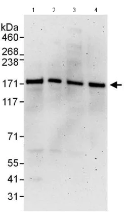 Western blot - Anti-SMC1A antibody (AB140493)