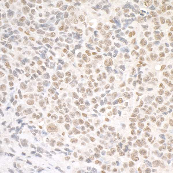 Immunohistochemistry (Formalin/PFA-fixed paraffin-embedded sections) - Anti-SMC1A antibody (AB9262), expandable thumbnail