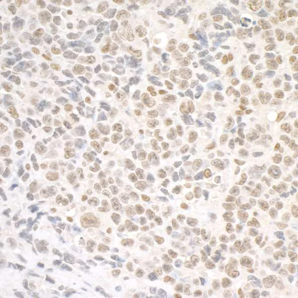 Immunohistochemistry (Formalin/PFA-fixed paraffin-embedded sections) - Anti-SMC1A antibody (AB9262)
