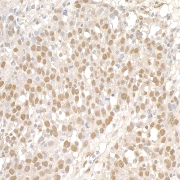 Immunohistochemistry (Formalin/PFA-fixed paraffin-embedded sections) - Anti-SMC1A antibody (AB9262)