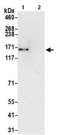 Immunoprecipitation - Anti-SMC1A antibody (AB9262), expandable thumbnail