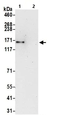 Immunoprecipitation - Anti-SMC1A antibody (AB9262)