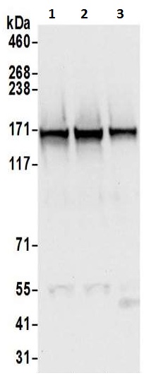 Western blot - Anti-SMC1A antibody (AB9262), expandable thumbnail
