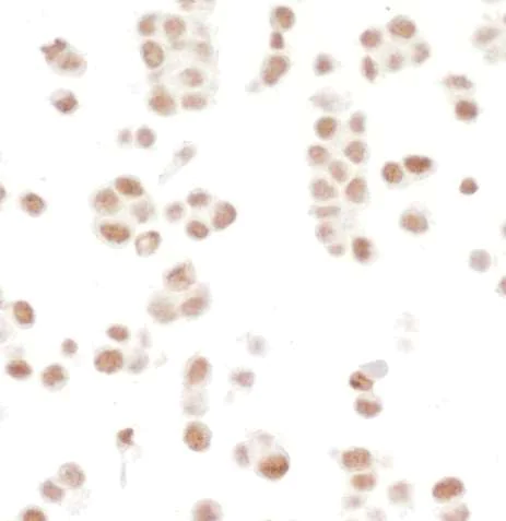 Immunocytochemistry - Anti-SMC1A antibody [BL-205-2G8] (AB243875)