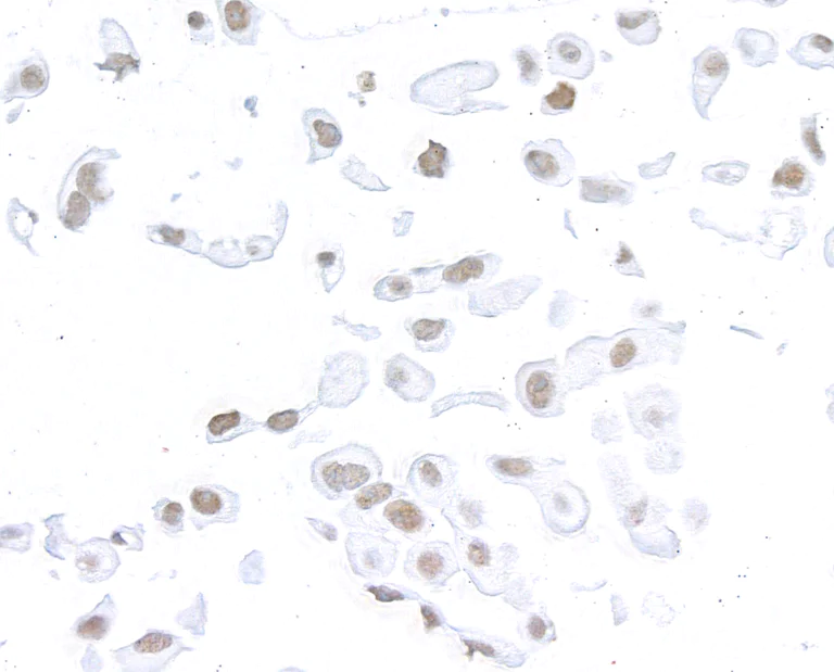 Immunocytochemistry - Anti-SMC1A antibody [BL-205-2G8] (AB243875)
