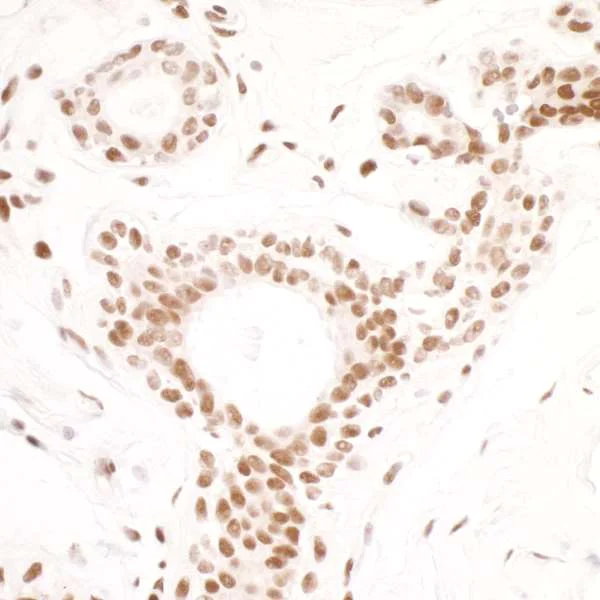 Immunohistochemistry (Formalin/PFA-fixed paraffin-embedded sections) - Anti-SMC1A antibody [BL-205-2G8] (AB243875)
