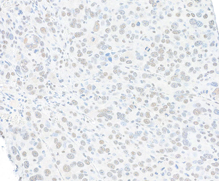Immunohistochemistry (Formalin/PFA-fixed paraffin-embedded sections) - Anti-SMC1A antibody [BL-205-2G8] (AB243875)