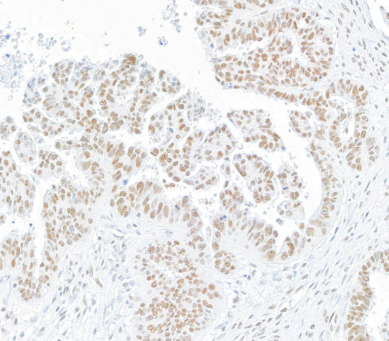 Immunohistochemistry (Formalin/PFA-fixed paraffin-embedded sections) - Anti-SMC1A antibody [BL-205-2G8] (AB243875)