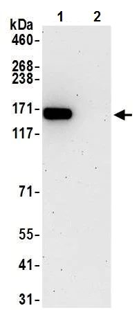 Immunoprecipitation - Anti-SMC1A antibody [BL-205-2G8] (AB243875)