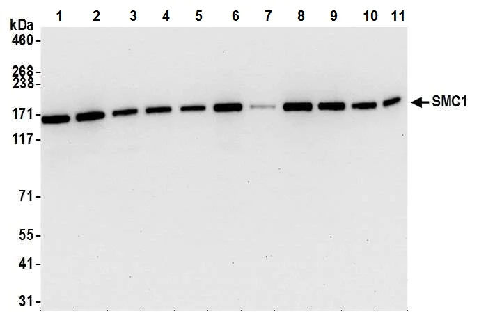 Western blot - Anti-SMC1A antibody [BL-205-2G8] (AB243875)