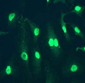 Immunocytochemistry/ Immunofluorescence - Anti-SMC1A antibody [EP2879Y] - BSA and Azide free (AB247404), expandable thumbnail