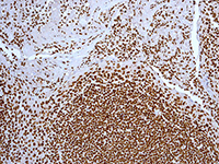 Immunohistochemistry (Formalin/PFA-fixed paraffin-embedded sections) - Anti-SMC1A antibody [EPR2879(2)] (AB109238), expandable thumbnail