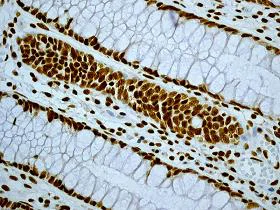 Immunohistochemistry (Formalin/PFA-fixed paraffin-embedded sections) - Anti-SMC1A antibody [EPR2879(2)] (AB109238)