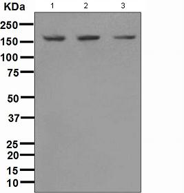 Western blot - Anti-SMC1A antibody [EPR2879(2)] (AB109238), expandable thumbnail