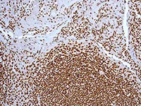 Immunohistochemistry (Formalin/PFA-fixed paraffin-embedded sections) - Anti-SMC1A antibody [EPR2879(2)] - BSA and Azide free (AB247802)