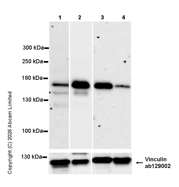Western blot - Anti-SMC1A antibody [EPR30532-7] (AB325922)
