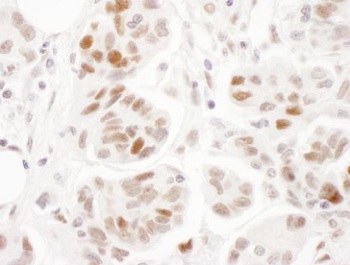 Immunohistochemistry (Formalin/PFA-fixed paraffin-embedded sections) - Anti-SMC1A (phospho S957) antibody (AB240573)