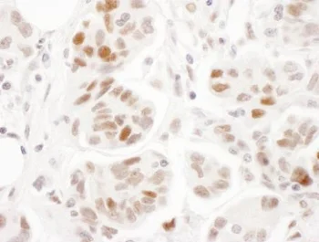 Immunohistochemistry (Formalin/PFA-fixed paraffin-embedded sections) - Anti-SMC1A (phospho S957) antibody (AB240573)