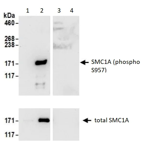 Immunoprecipitation - Anti-SMC1A (phospho S957) antibody (AB240573)