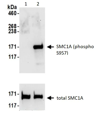 Western blot - Anti-SMC1A (phospho S957) antibody (AB240573)
