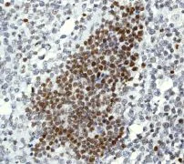 Immunohistochemistry (Formalin/PFA-fixed paraffin-embedded sections) - Anti-SMC1A (phospho S957) antibody [EPR2857Y] (AB75768)