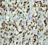 Immunohistochemistry (Formalin/PFA-fixed paraffin-embedded sections) - Anti-SMC1A (phospho S957) antibody [EPR2857Y] - BSA and Azide free (AB247395), expandable thumbnail