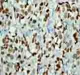 Immunohistochemistry (Formalin/PFA-fixed paraffin-embedded sections) - Anti-SMC1A (phospho S957) antibody [EPR2857Y] - BSA and Azide free (AB247395)