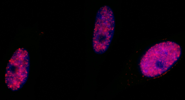 Immunocytochemistry - Anti-SMC1A (phospho S966) antibody (AB1276), expandable thumbnail