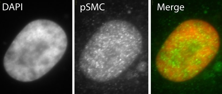 Immunocytochemistry - Anti-SMC1A (phospho S966) antibody (AB1276), expandable thumbnail