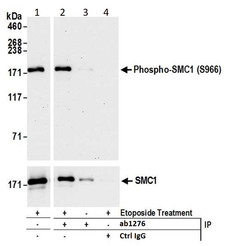Immunoprecipitation - Anti-SMC1A (phospho S966) antibody (AB1276), expandable thumbnail